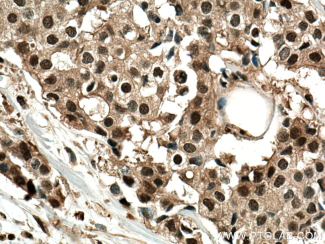 PSMD2 Antibody in Immunohistochemistry (Paraffin) (IHC (P))