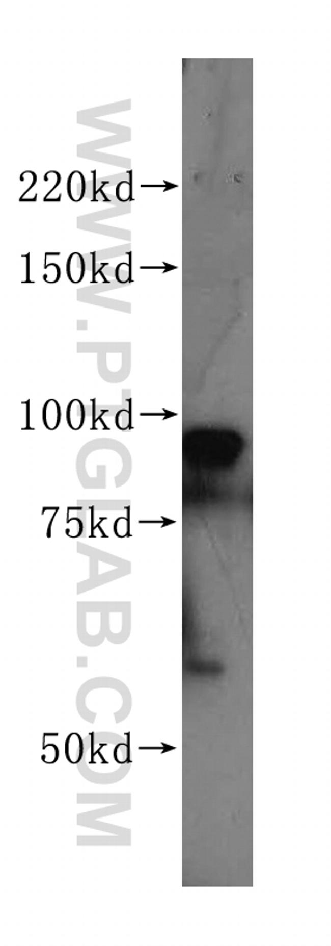 PSMD2 Antibody in Western Blot (WB)