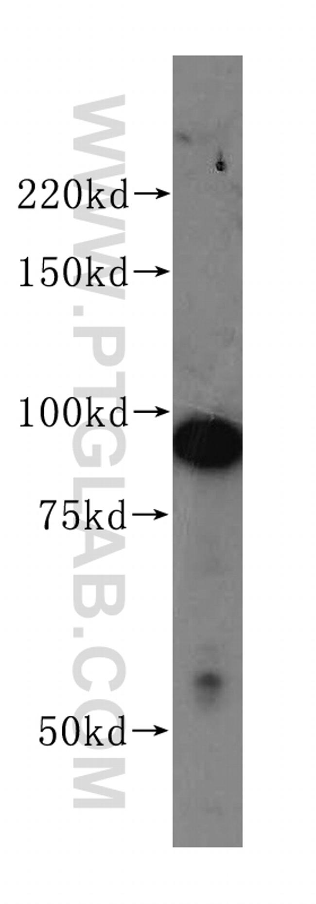 PSMD2 Antibody in Western Blot (WB)