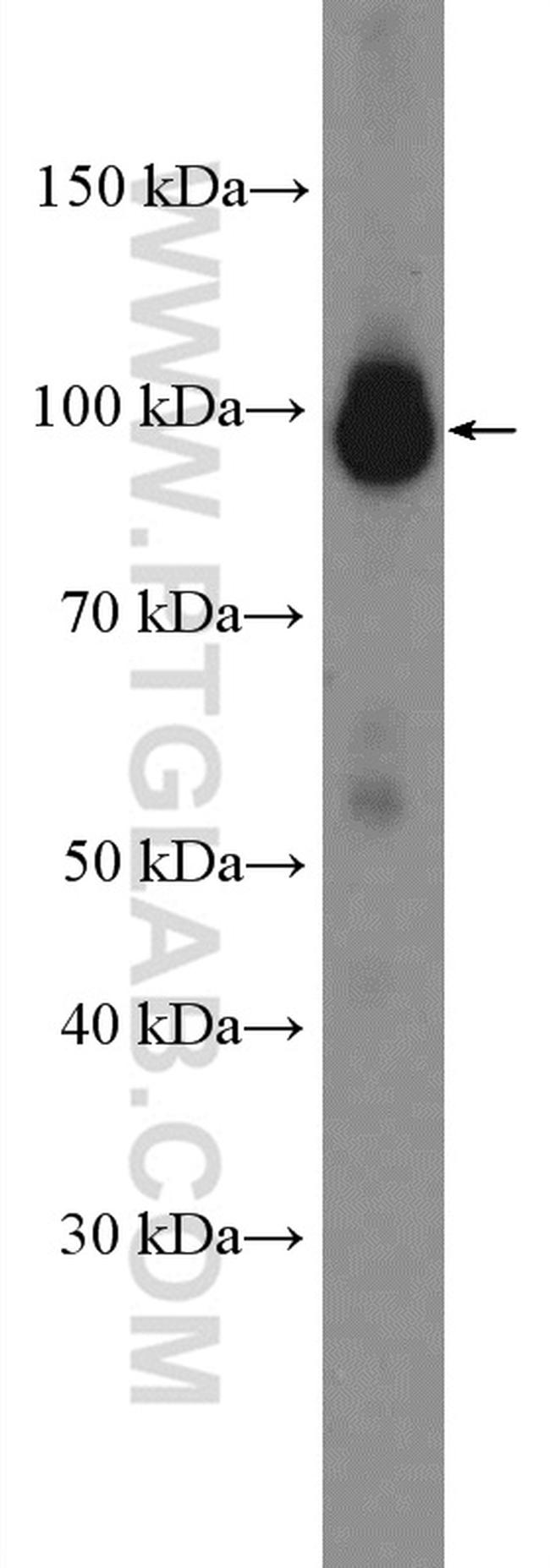 PSMD2 Antibody in Western Blot (WB)