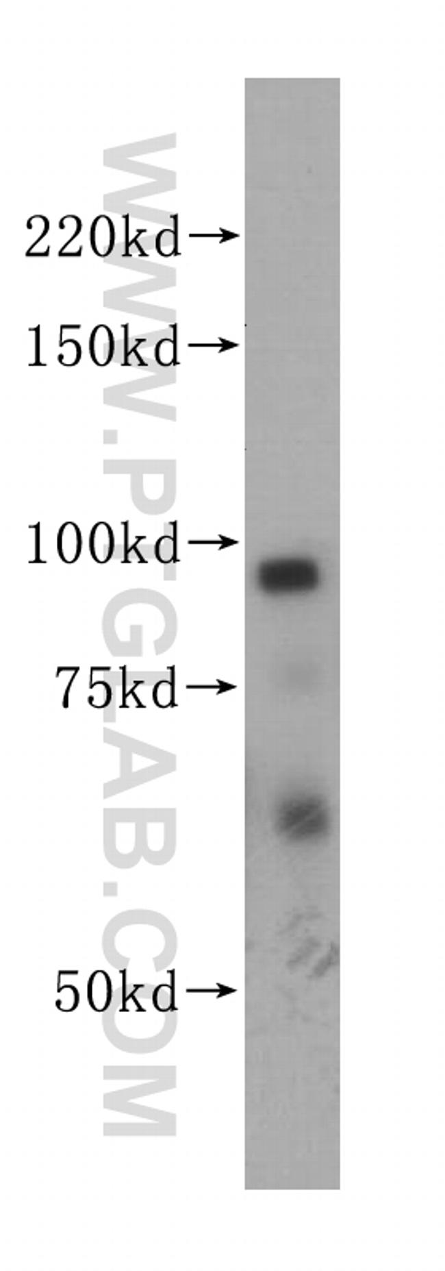 PSMD2 Antibody in Western Blot (WB)