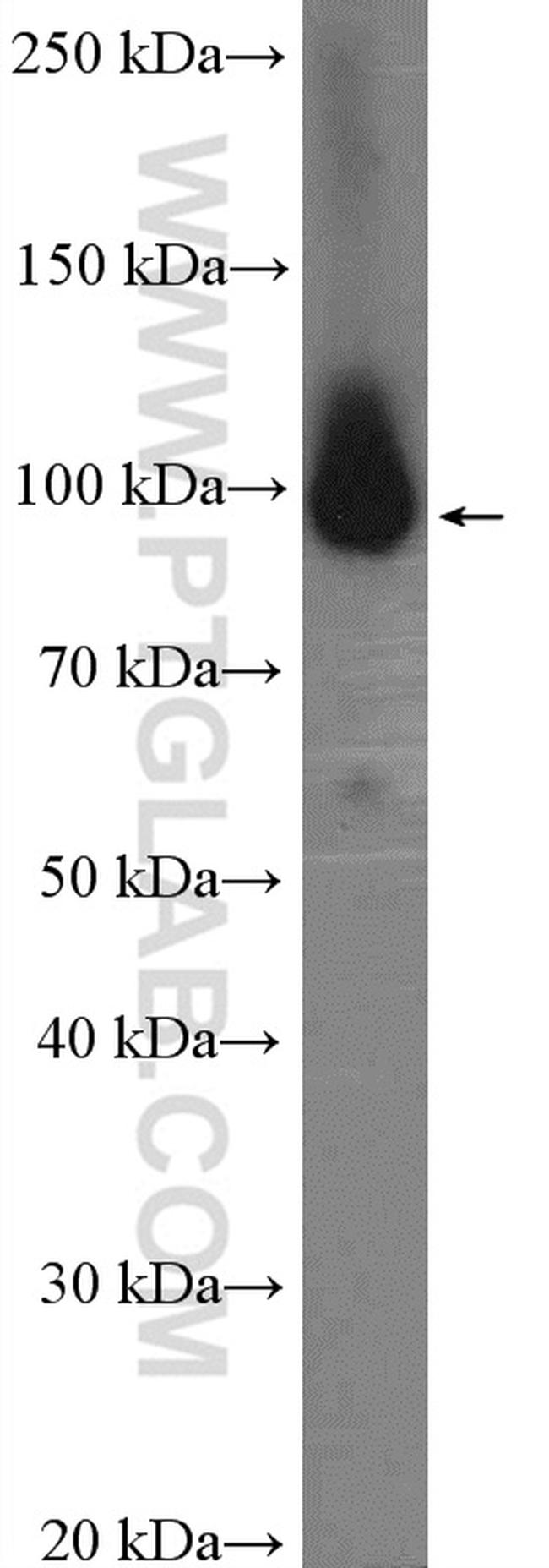 PSMD2 Antibody in Western Blot (WB)