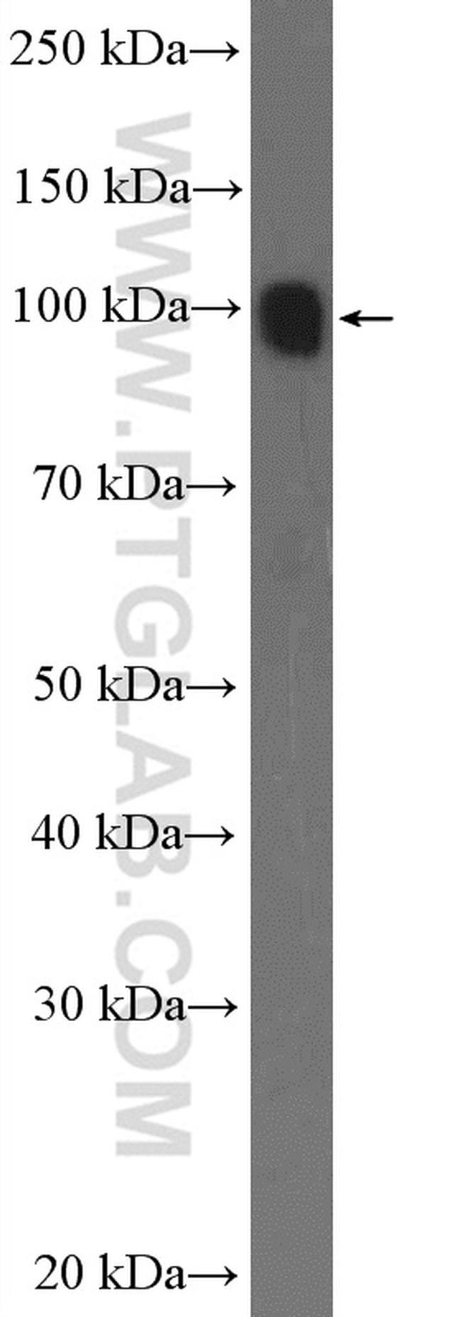 PSMD2 Antibody in Western Blot (WB)