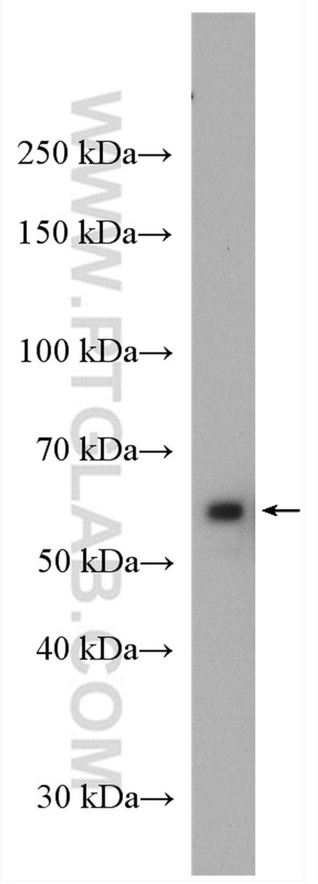 CORO1C Antibody in Western Blot (WB)