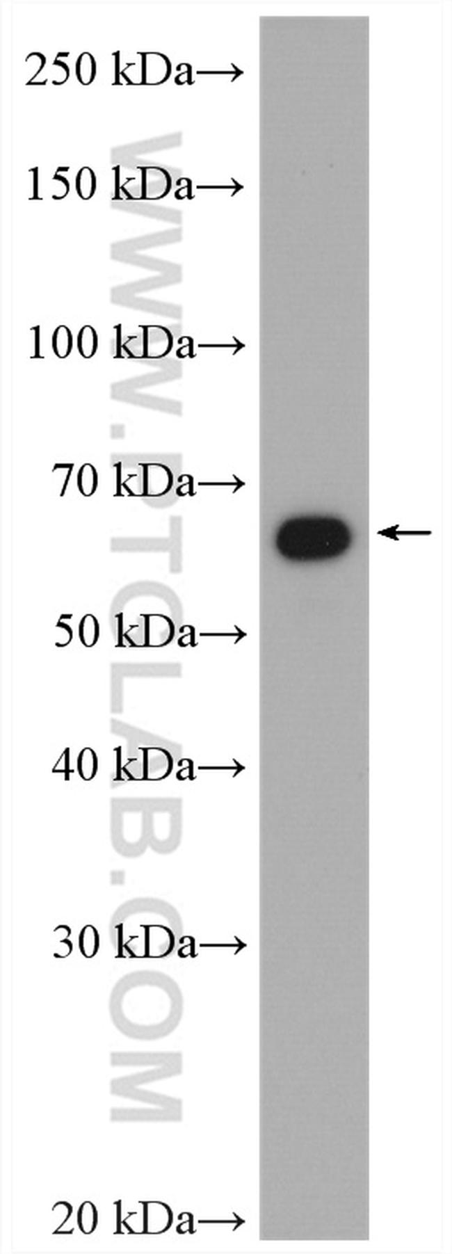 CORO1C Antibody in Western Blot (WB)