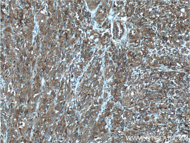 CORO1C Antibody in Immunohistochemistry (Paraffin) (IHC (P))