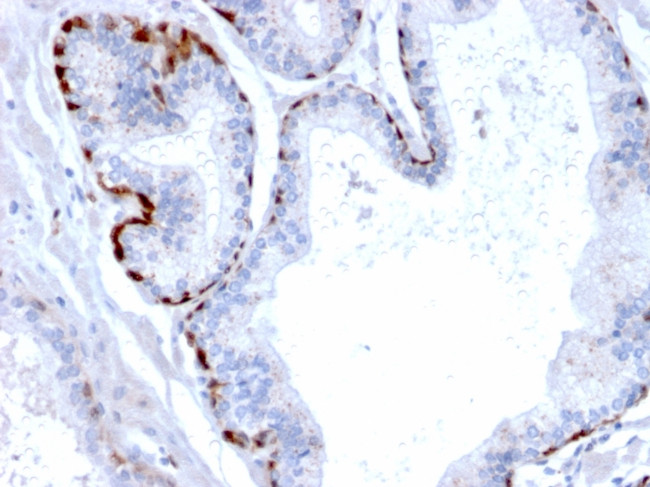 Cystatin A Antibody in Immunohistochemistry (Paraffin) (IHC (P))