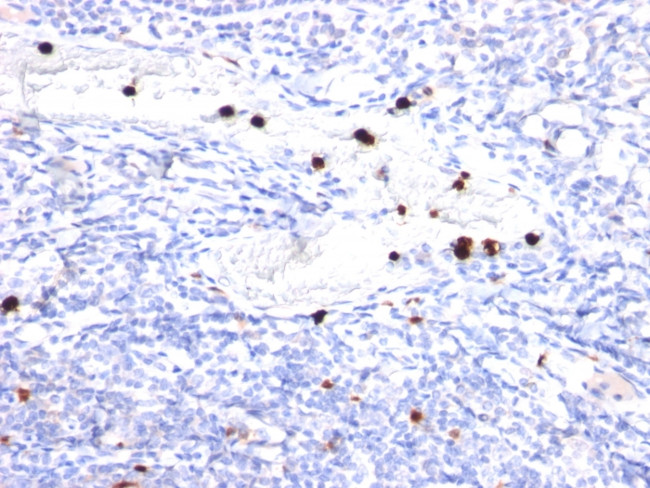 Cystatin A Antibody in Immunohistochemistry (Paraffin) (IHC (P))