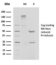 Cystatin A Antibody in SDS-PAGE (SDS-PAGE)