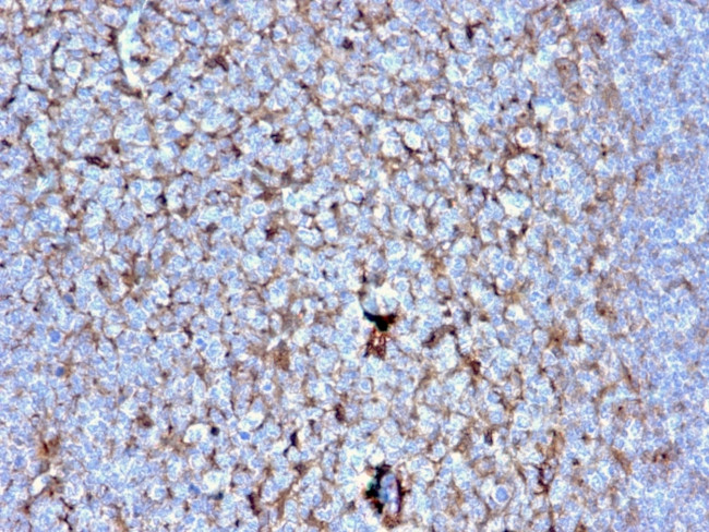 Cystatin A Antibody in Immunohistochemistry (Paraffin) (IHC (P))