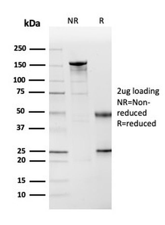 Cystatin A Antibody in SDS-PAGE (SDS-PAGE)