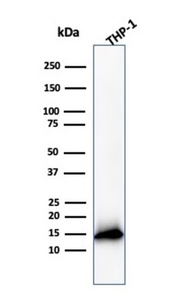 Cystatin A Antibody in Western Blot (WB)