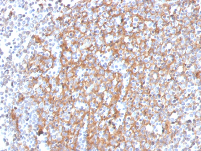 Cystatin A Antibody in Immunohistochemistry (Paraffin) (IHC (P))