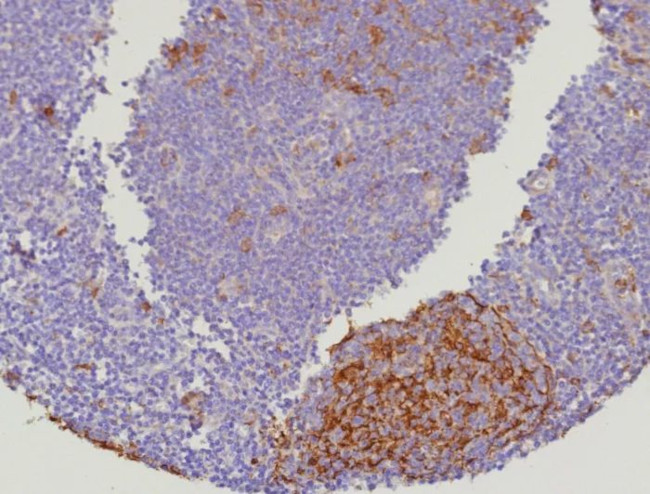 Cystatin A Antibody in Immunohistochemistry (Paraffin) (IHC (P))