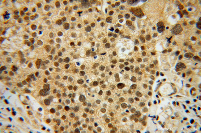 OSBPL2 Antibody in Immunohistochemistry (Paraffin) (IHC (P))