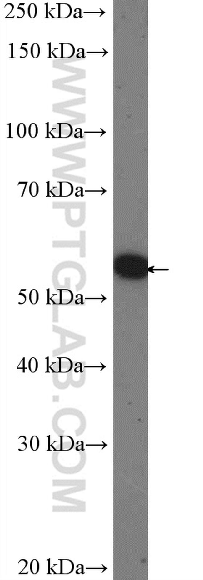 OSBPL2 Antibody in Western Blot (WB)