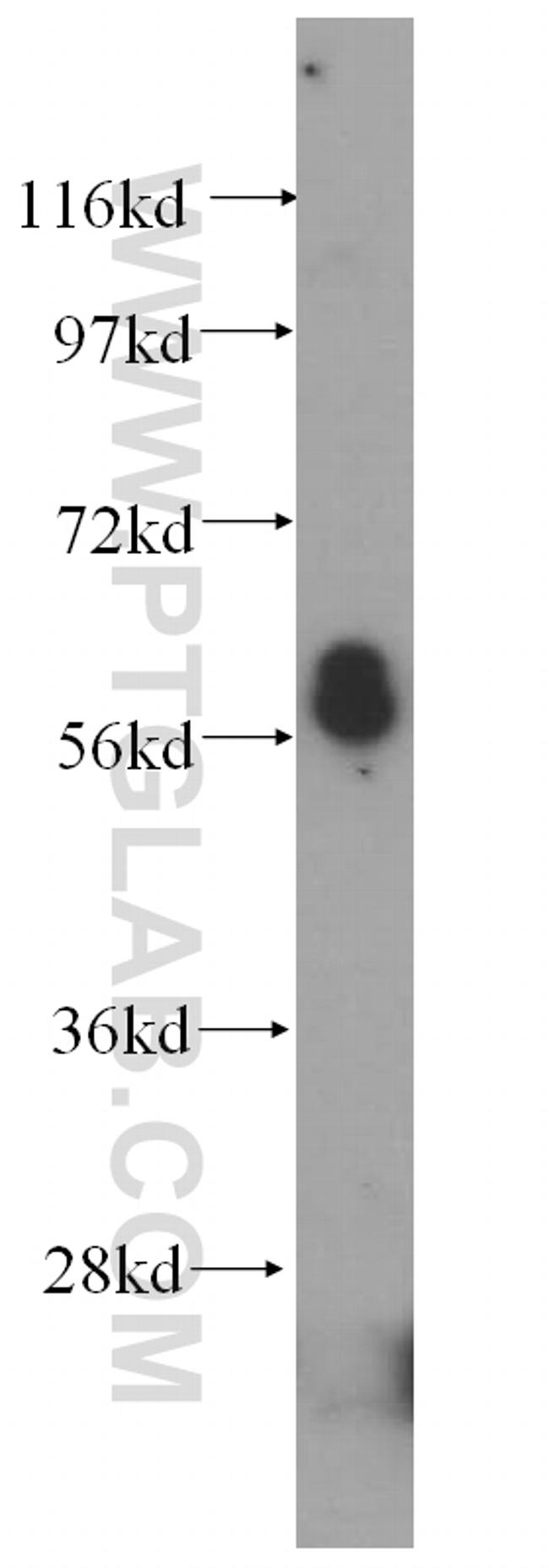 OSBPL2 Antibody in Western Blot (WB)