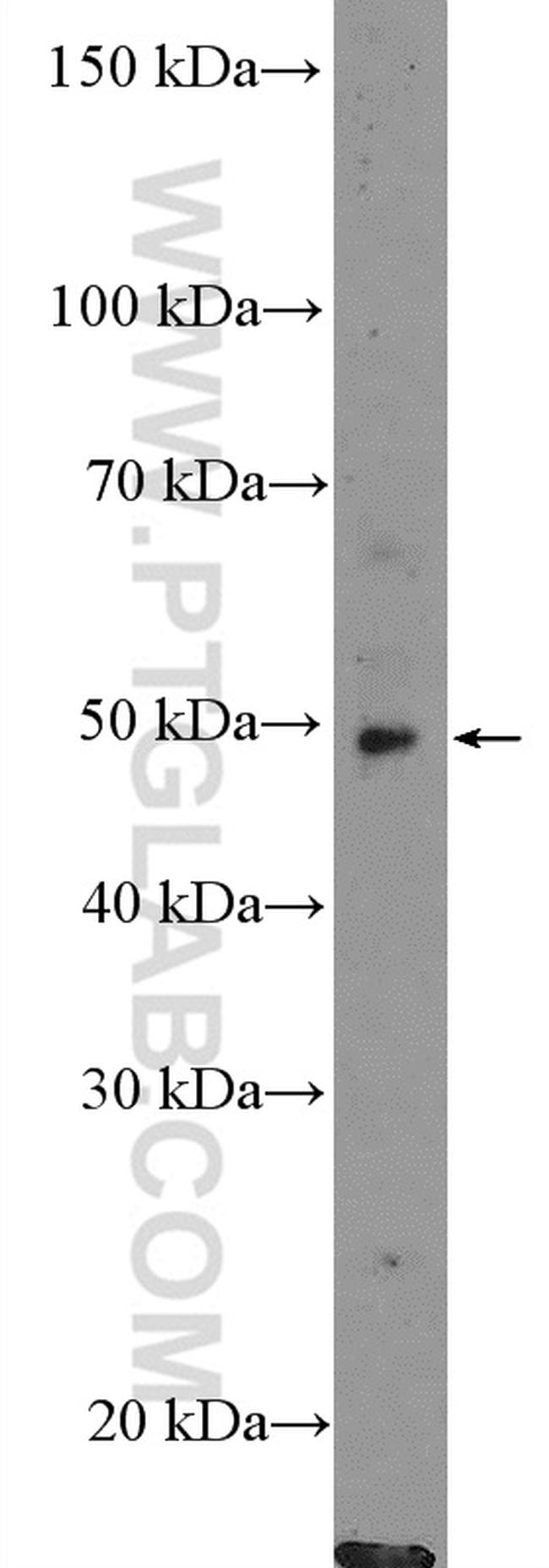 OSBPL2 Antibody in Western Blot (WB)