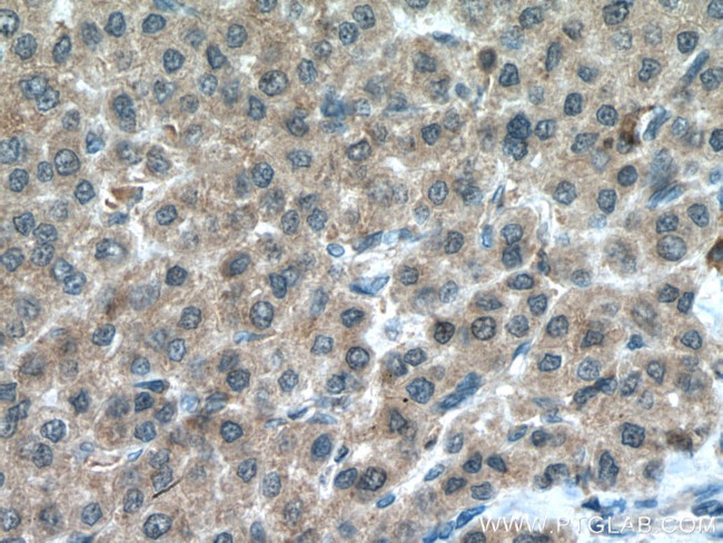 PSMC5 Antibody in Immunohistochemistry (Paraffin) (IHC (P))