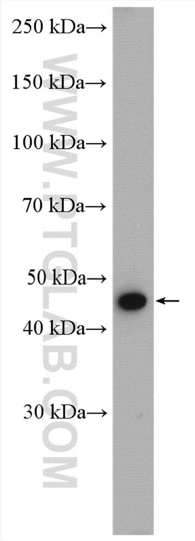 PSMC5 Antibody in Western Blot (WB)