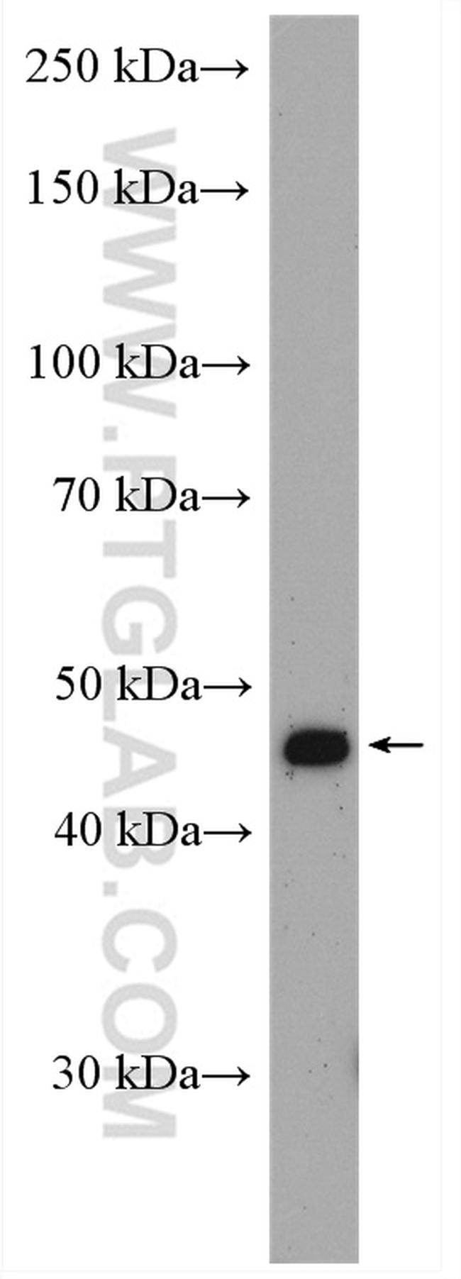 PSMC5 Antibody in Western Blot (WB)