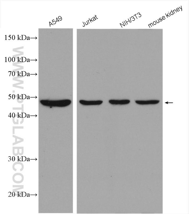 PSMC5 Antibody in Western Blot (WB)