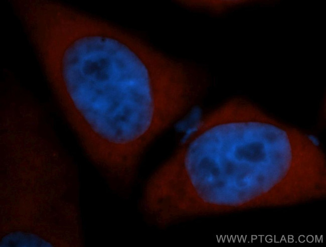 COMT Antibody in Immunocytochemistry (ICC/IF)