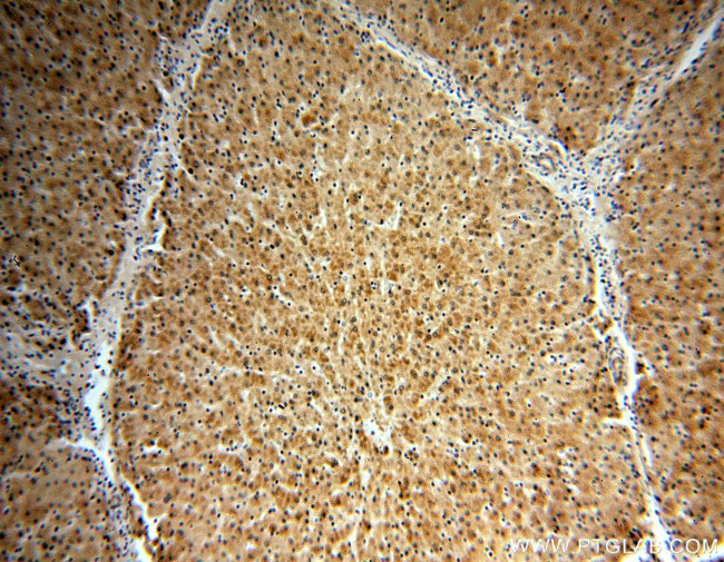 COMT Antibody in Immunohistochemistry (Paraffin) (IHC (P))