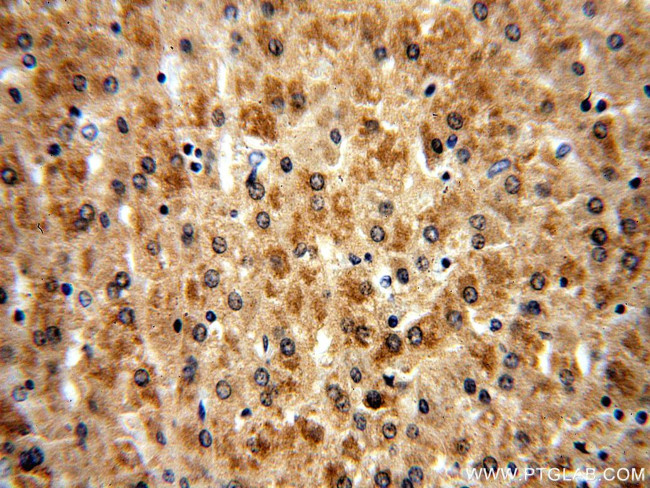 COMT Antibody in Immunohistochemistry (Paraffin) (IHC (P))