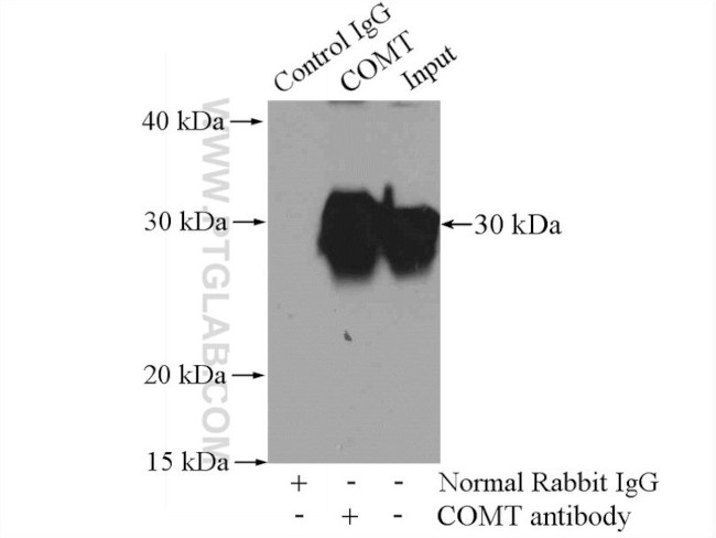 COMT Antibody in Immunoprecipitation (IP)