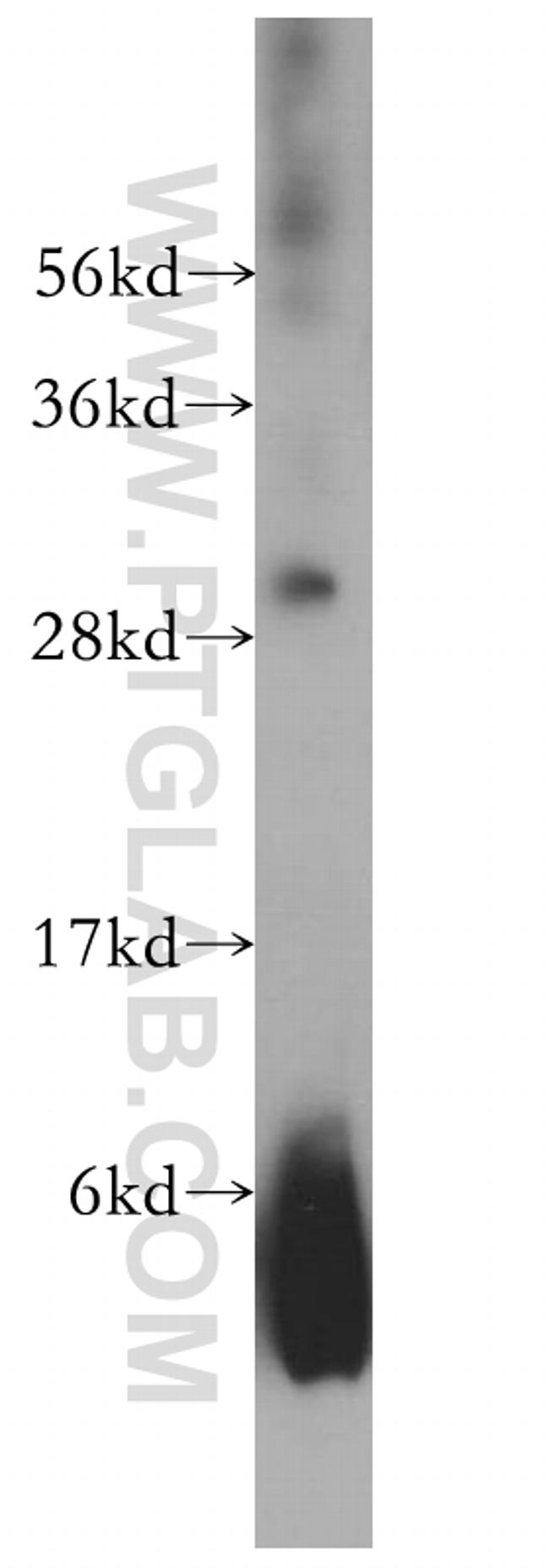 COMT Antibody in Western Blot (WB)