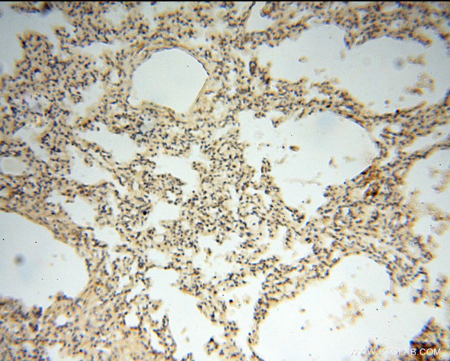 ACAT2 Antibody in Immunohistochemistry (Paraffin) (IHC (P))