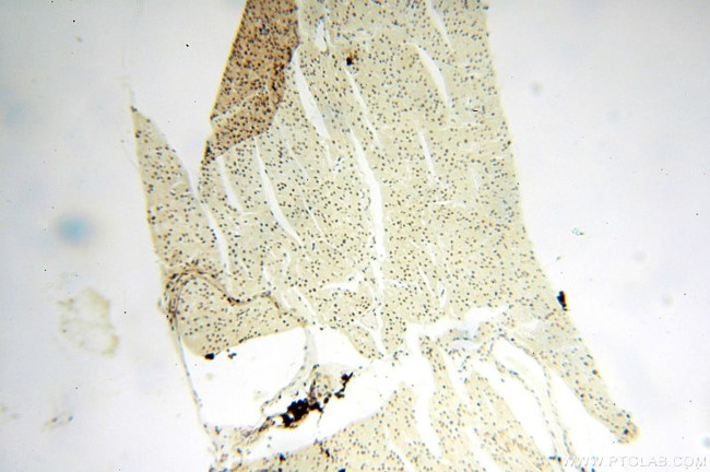 WRAP53 Antibody in Immunohistochemistry (Paraffin) (IHC (P))