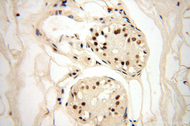 WRAP53 Antibody in Immunohistochemistry (Paraffin) (IHC (P))