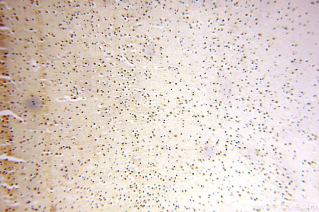 WRAP53 Antibody in Immunohistochemistry (Paraffin) (IHC (P))