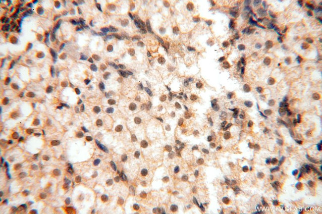 WRAP53 Antibody in Immunohistochemistry (Paraffin) (IHC (P))