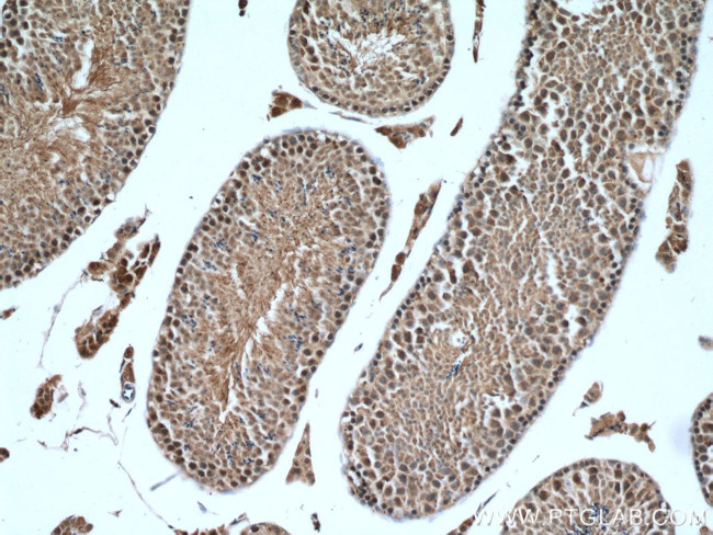 WRAP53 Antibody in Immunohistochemistry (Paraffin) (IHC (P))