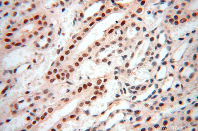 WRAP53 Antibody in Immunohistochemistry (Paraffin) (IHC (P))