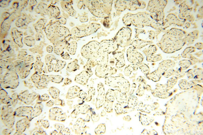 WRAP53 Antibody in Immunohistochemistry (Paraffin) (IHC (P))