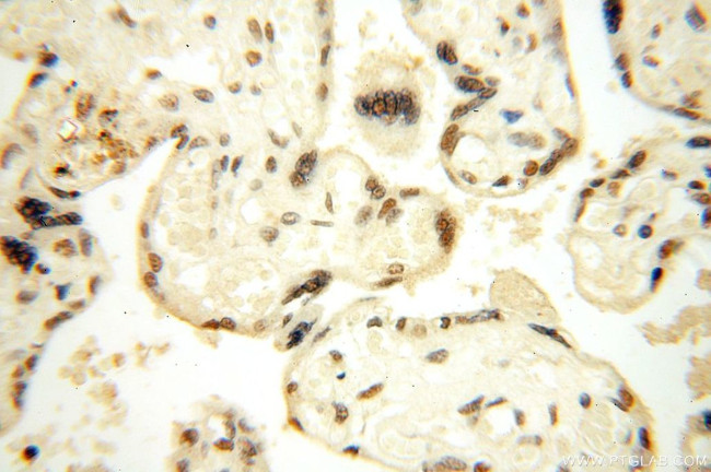 WRAP53 Antibody in Immunohistochemistry (Paraffin) (IHC (P))