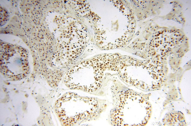 WRAP53 Antibody in Immunohistochemistry (Paraffin) (IHC (P))