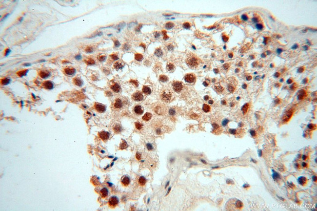 WRAP53 Antibody in Immunohistochemistry (Paraffin) (IHC (P))