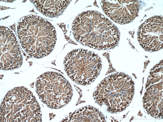 WRAP53 Antibody in Immunohistochemistry (Paraffin) (IHC (P))