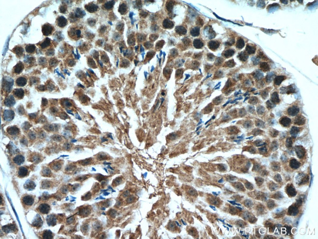 WRAP53 Antibody in Immunohistochemistry (Paraffin) (IHC (P))