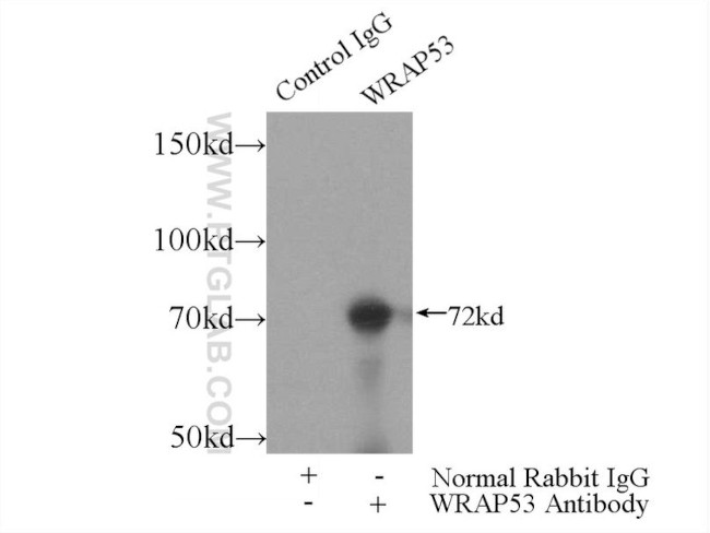 WRAP53 Antibody in Immunoprecipitation (IP)