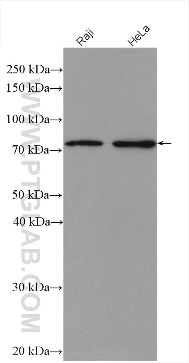 WRAP53 Antibody in Western Blot (WB)