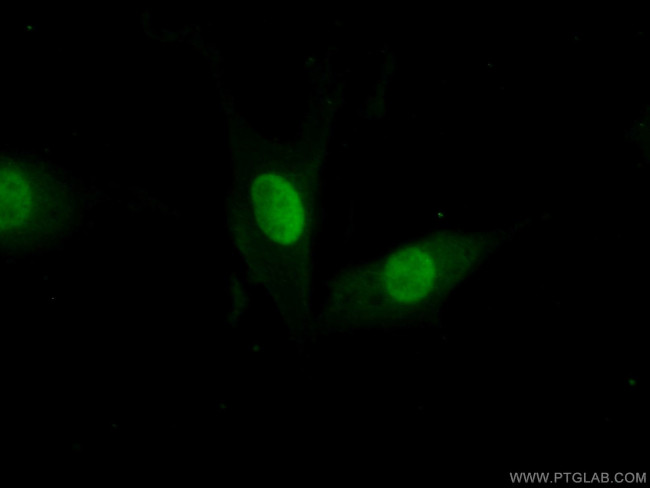 FEN1 Antibody in Immunocytochemistry (ICC/IF)