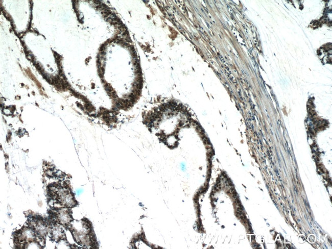 FEN1 Antibody in Immunohistochemistry (Paraffin) (IHC (P))