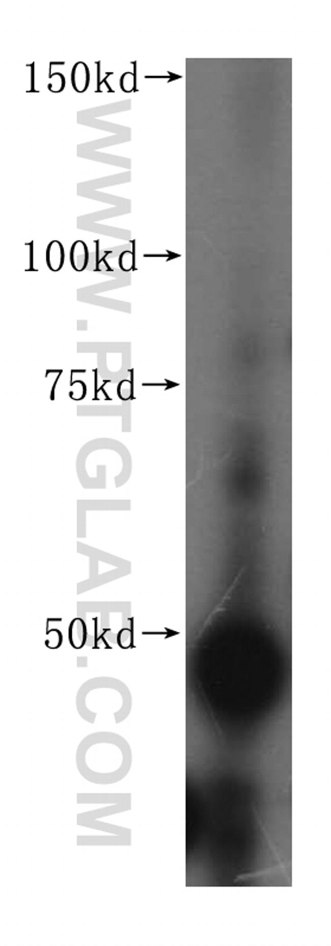 FEN1 Antibody in Western Blot (WB)