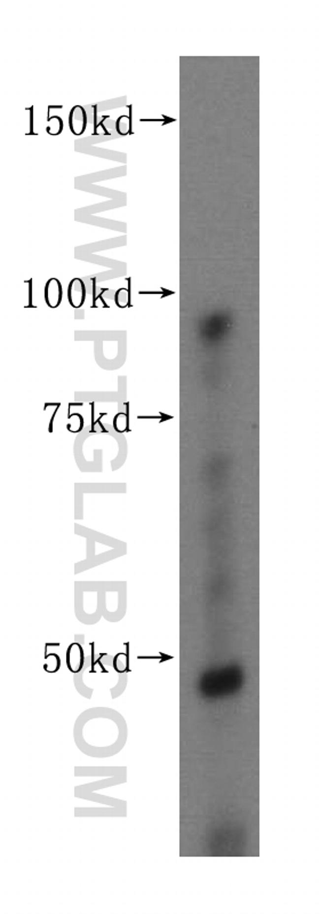 FEN1 Antibody in Western Blot (WB)